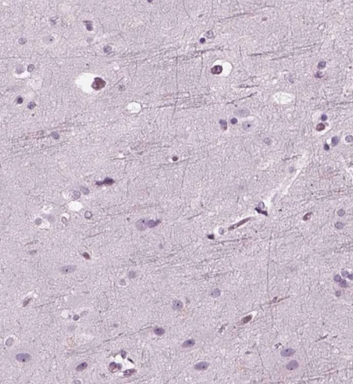 Recoverin Antibody - BSA Free