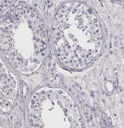 VMAT1/SLC18A1 Antibody