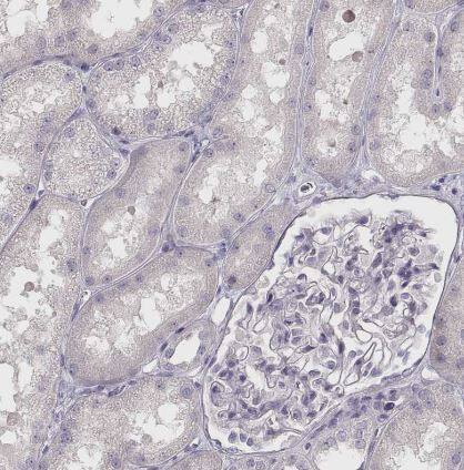 VMAT1/SLC18A1 Antibody