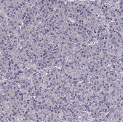 VMAT1/SLC18A1 Antibody