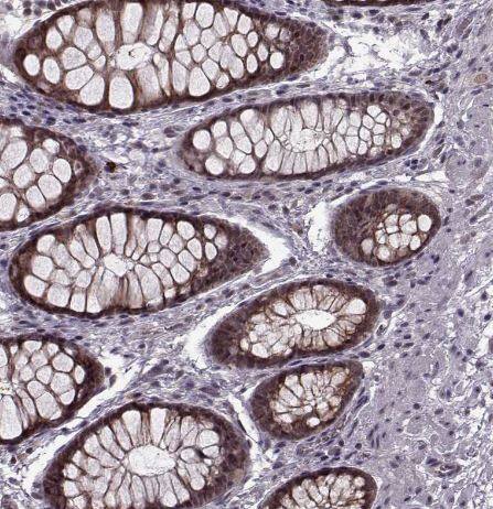 PLC-beta 4 Antibody PLC-beta 4 Antibody