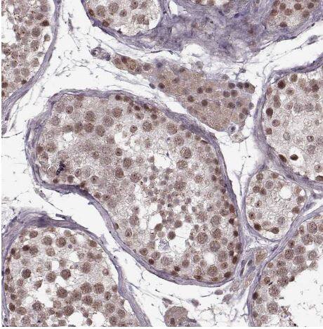 PLC-beta 4 Antibody PLC-beta 4 Antibody