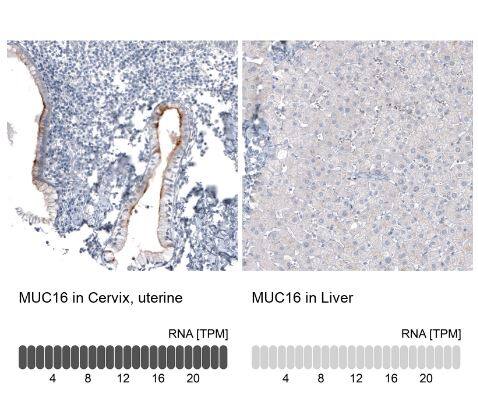 CA125/MUC16 Antibody (CL2782)