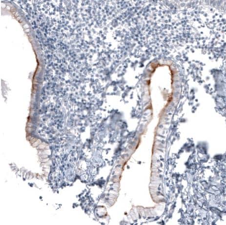 CA125/MUC16 Antibody (CL2782)
