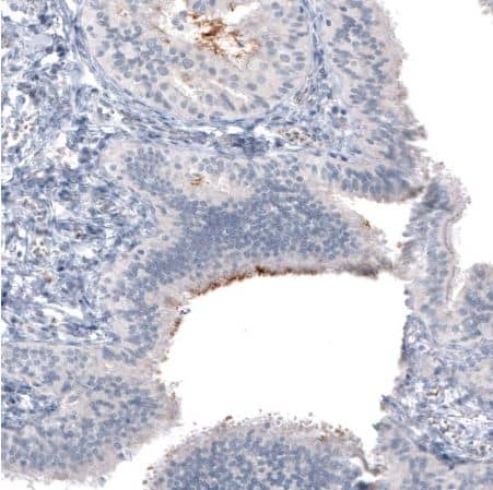 CA125/MUC16 Antibody (CL2782)
