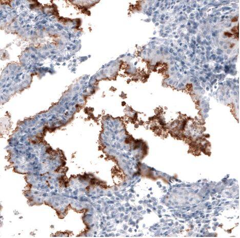 CA125/MUC16 Antibody (CL2782)