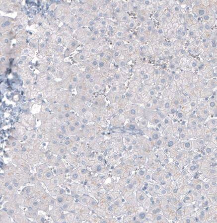 CA125/MUC16 Antibody (CL2782)