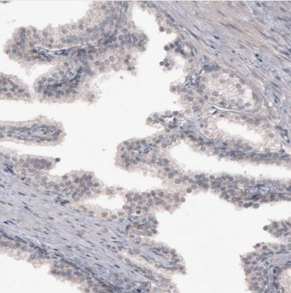 FoxJ1/HFH4 Antibody (CL3991) - BSA Free