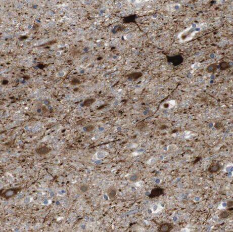 Dcp1a Antibody Dcp1a Antibody