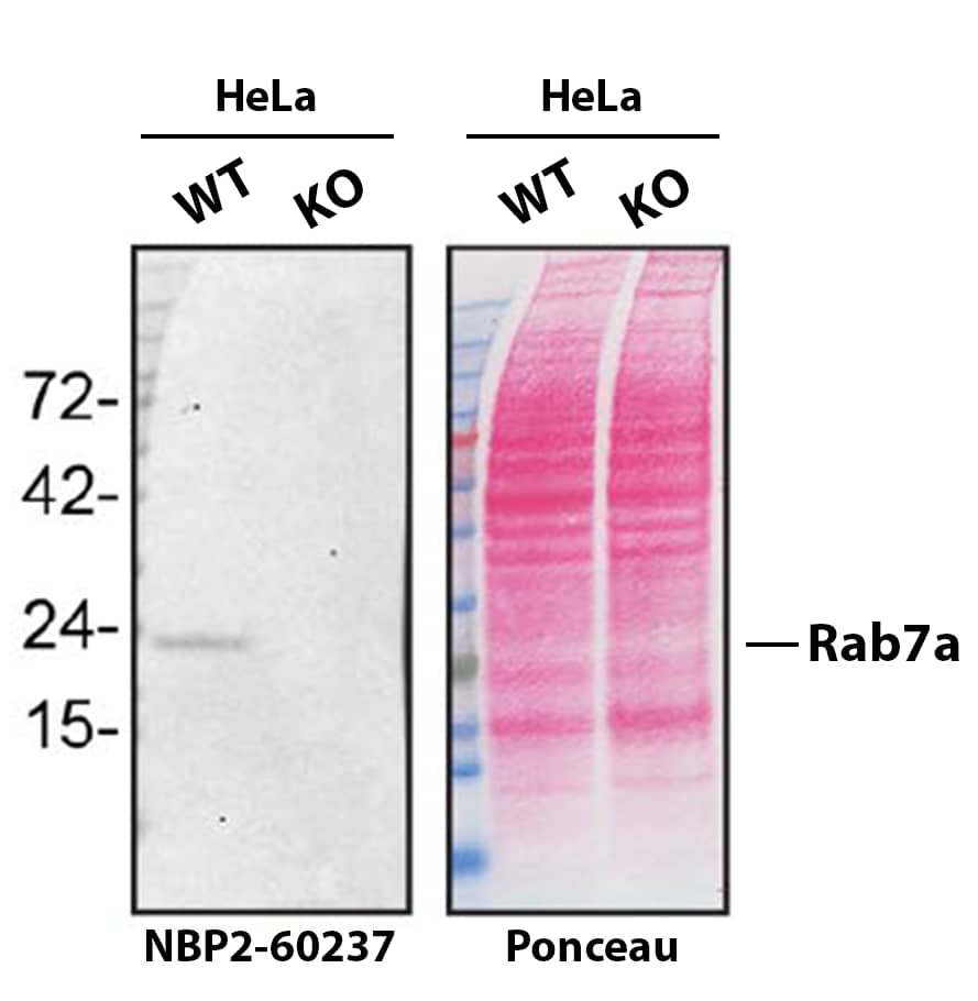 Western Blot Shows Rab7a Specificity Using Knockout Cell Line. Rab7a Antibody (10E4) - BSA Free Western Blot Shows Rab7a Specificity Using Knockout Cell Line.
