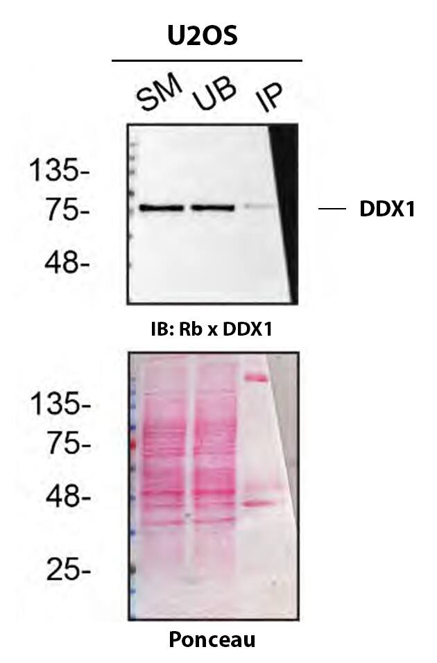 DDX1 Antibody (3E5E2) - BSA Free Detection of DDX1 by Immunoprecipitation.