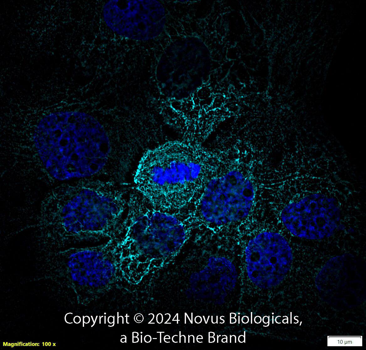 Cytokeratin 5 Antibody - BSA Free
