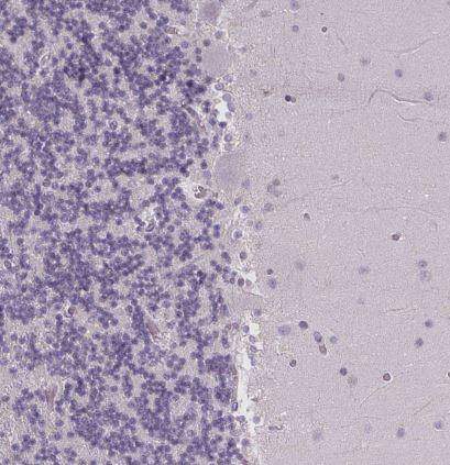 FCRL3/FcRH3 Antibody