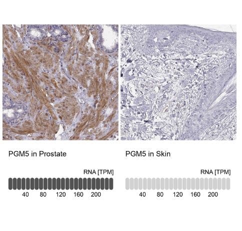 Phosphoglucomutase 5 Antibody