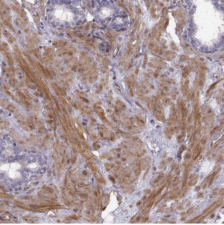 Phosphoglucomutase 5 Antibody