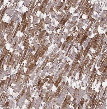 Phosphoglucomutase 5 Antibody