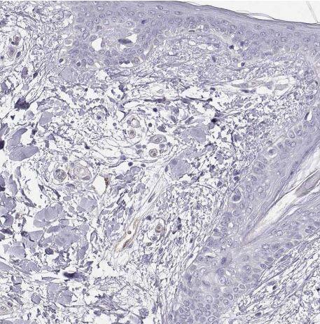 Phosphoglucomutase 5 Antibody