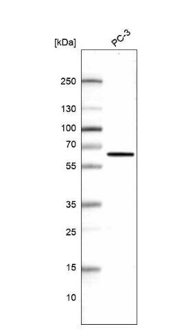 Phosphoglucomutase 5 Antibody
