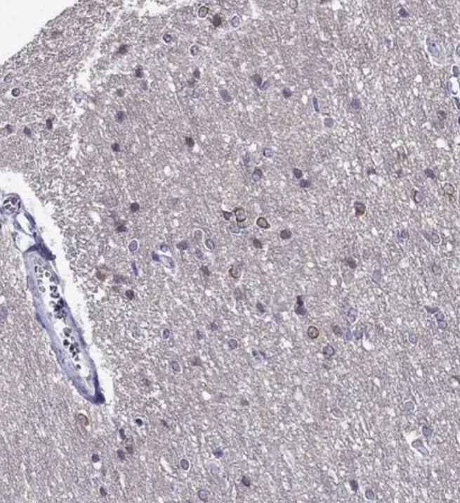 KCNJ10 Antibody - BSA Free