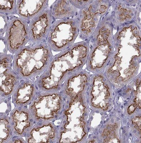 Cav1.4 Antibody Cav1.4 Antibody