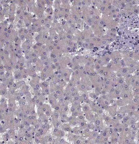Cav1.4 Antibody Cav1.4 Antibody