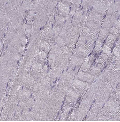 Cav1.4 Antibody Cav1.4 Antibody