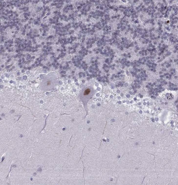 LIM1 Antibody - BSA Free