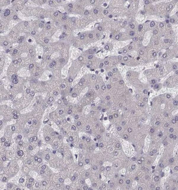 LIM1 Antibody - BSA Free