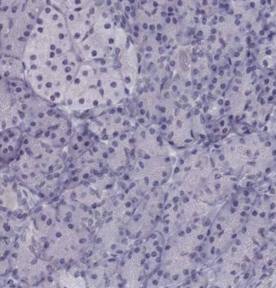 LIM1 Antibody - BSA Free