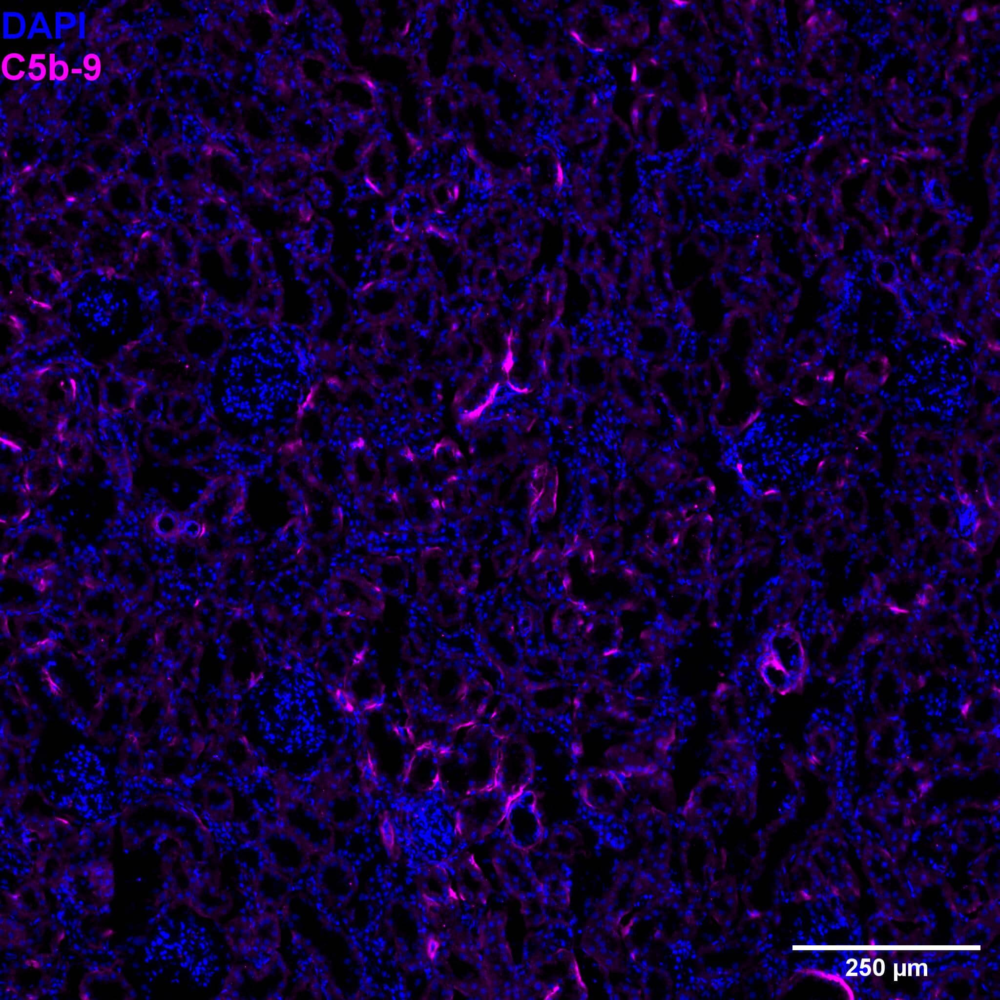 C5b-9 Antibody (2A1)