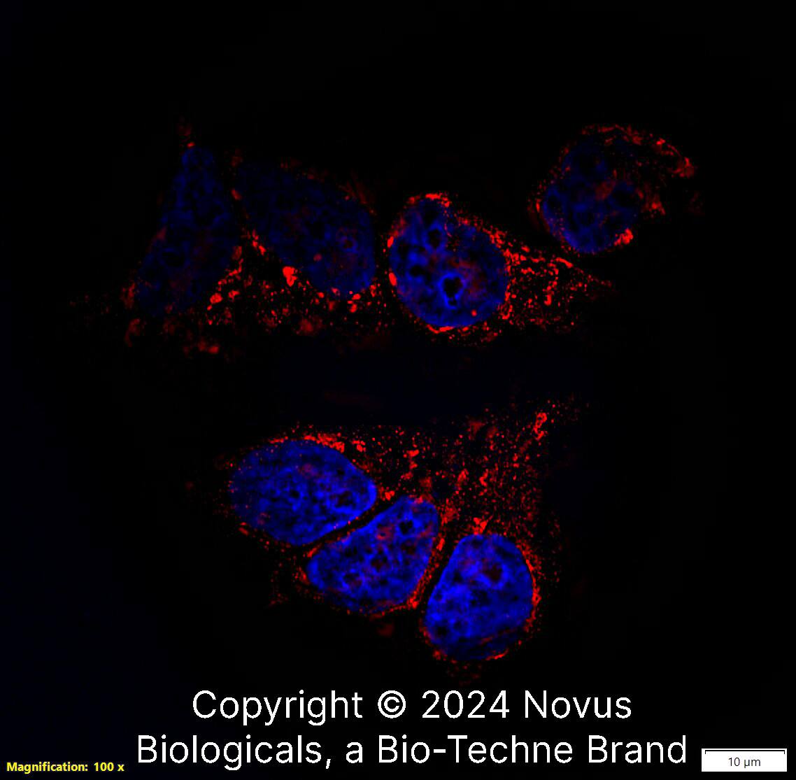 TSG101 Antibody - BSA Free