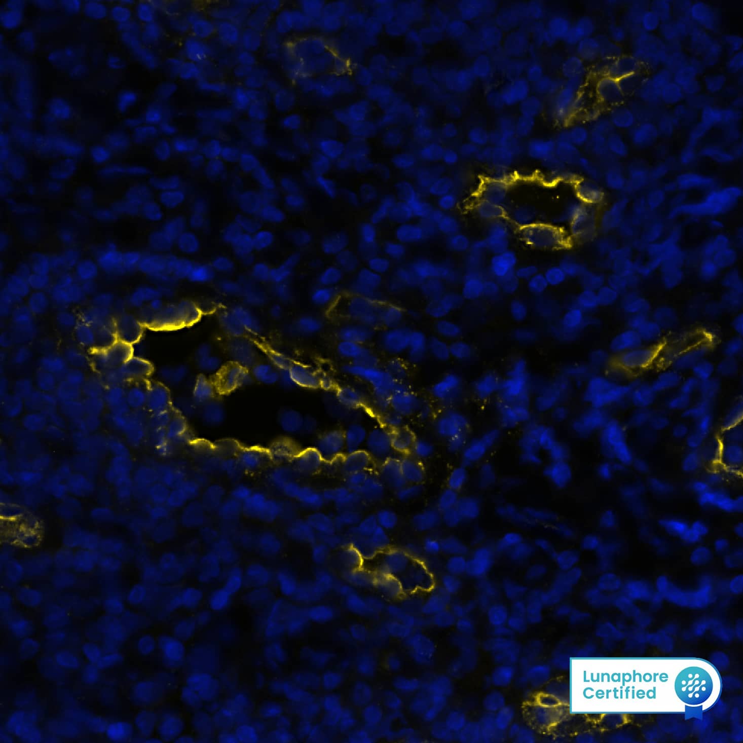 Detection of Peripheral Node Addressin in Human Tonsil via seqIF™ staining on COMET™ Peripheral Node Addressin Antibody (MECA-79R) - BSA Free Detection of Peripheral Node Addressin in Human Tonsil via seqIF™ staining on COMET™
