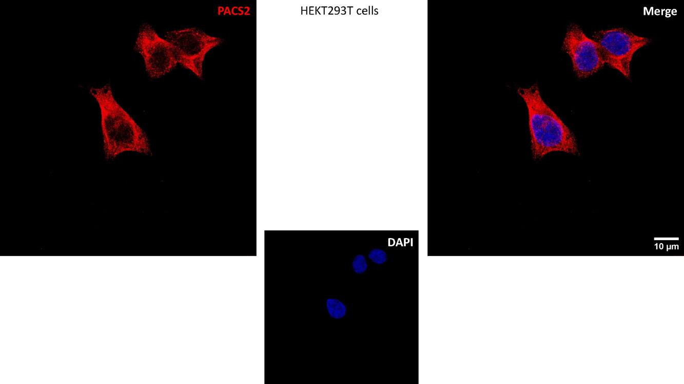 PACS2 Antibody - BSA Free