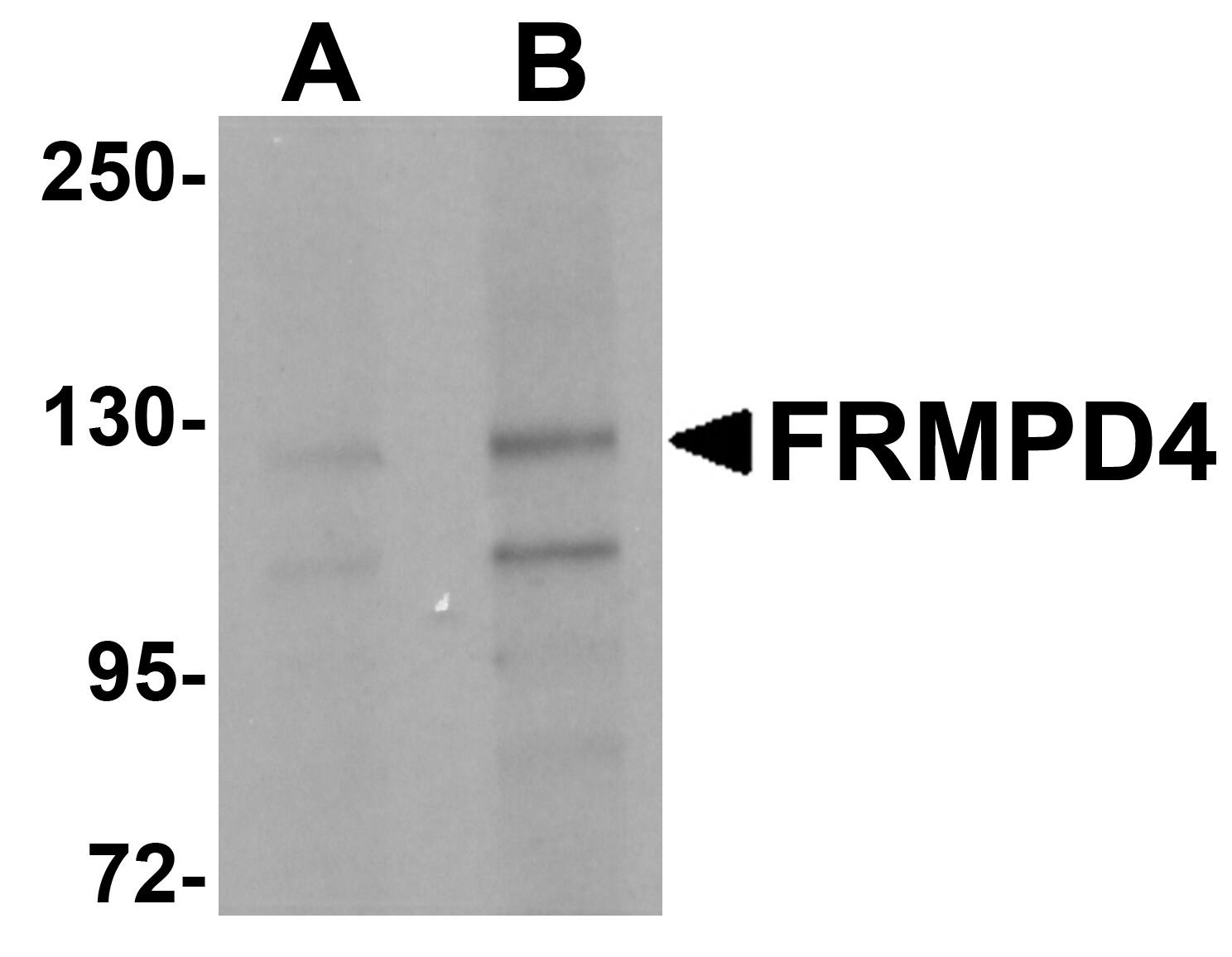 Preso/FRMPD4 Antibody - BSA Free