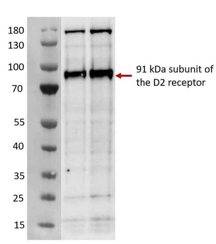 Dopamine D2R/DRD2 Antibody