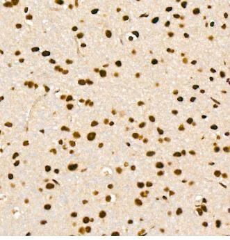 EFTUD2 Antibody - BSA Free