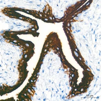 Uroplakin III Antibody - BSA Free