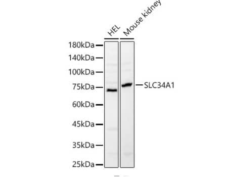 SLC34A1 Antibody - BSA Free