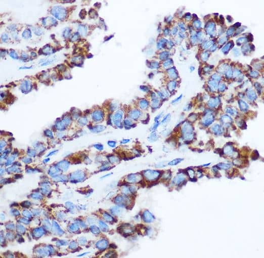 Pyruvate Dehydrogenase E1-alpha subunit Antibody - Azide and BSA Free