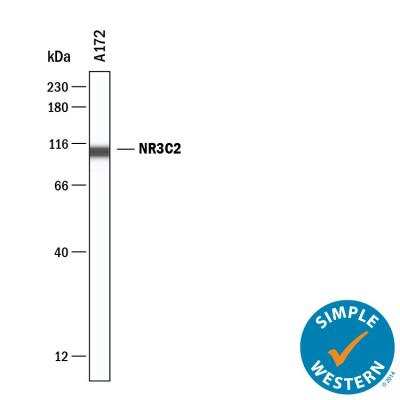 Mineralocorticoid R/NR3C2 Antibody - Azide and BSA Free Simple Western: Mineralocorticoid R/NR3C2 Antibody [NBP2-99010] -