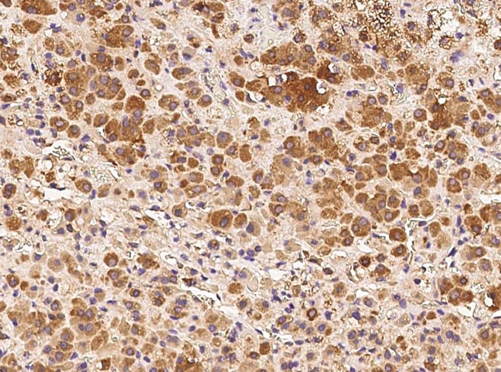 DDRGK1 Antibody