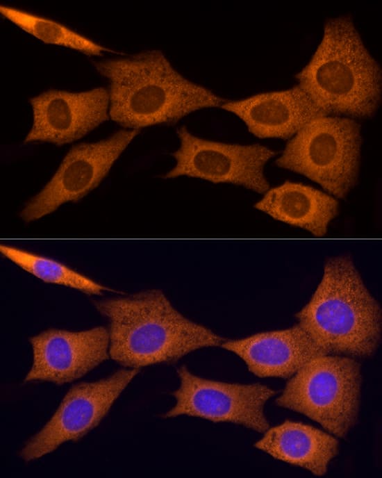 Tumstatin/COL4A3 Antibody