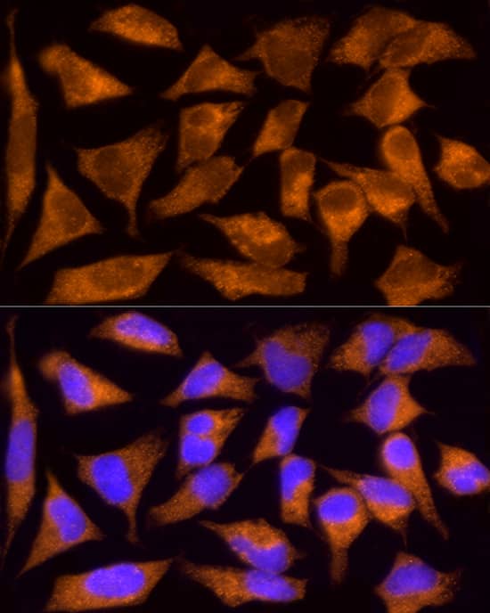 Tumstatin/COL4A3 Antibody