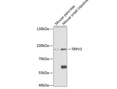 Vanilloid R-like 3/TRPV3 Antibody - BSA Free