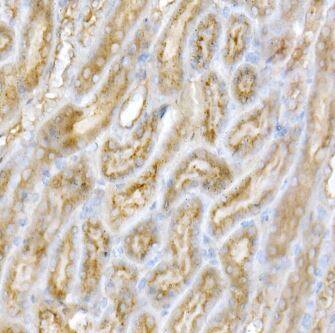 Galactosylceramidase/GALC Antibody - BSA Free