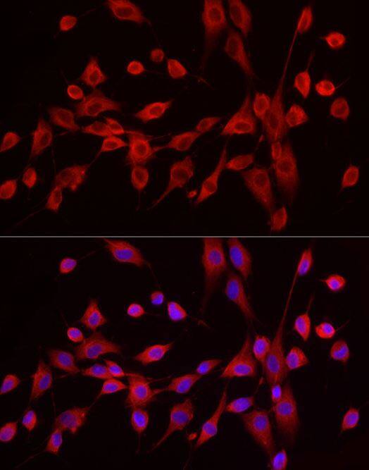 Exostosin 1 Antibody