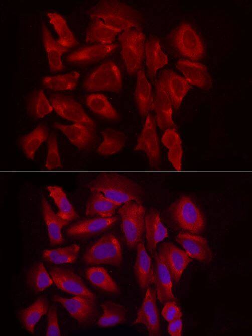 Exostosin 1 Antibody