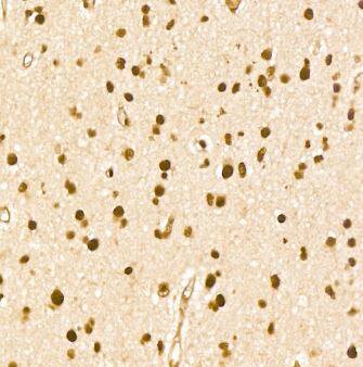 THRAP3 Antibody - Azide and BSA Free