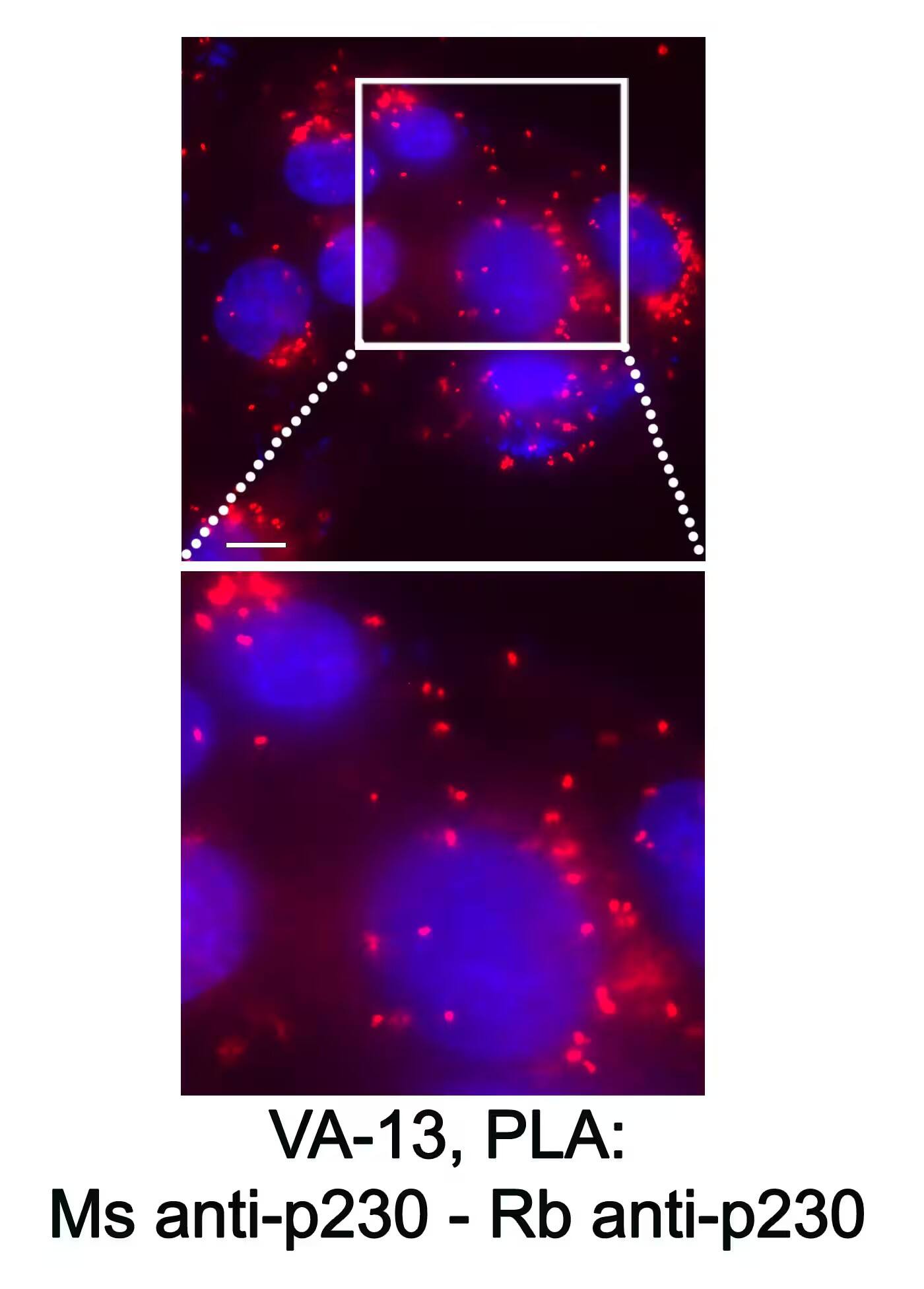GOLGA4 Antibody - BSA Free