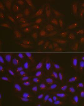 ATG14 Antibody - Azide and BSA Free